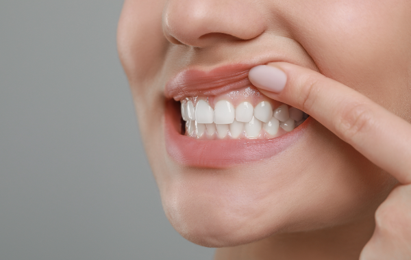 infection pulpaire paris abces Traitement de nécrose Dentiste Attuil Régis | Endodontie à Paris 17